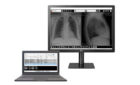 diagnostic workstation-medical imaging diagnostic software-Med Diag